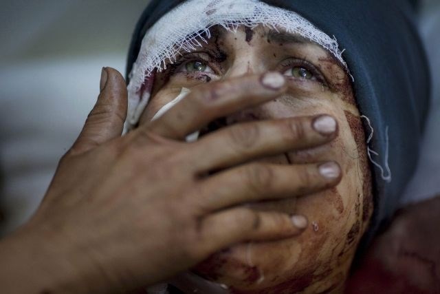 Rodrigo Abd iz Argentine, ki dela za Associated Press, je marca posnel fotografijo Sirke Aide potem, ko je bila hudo...