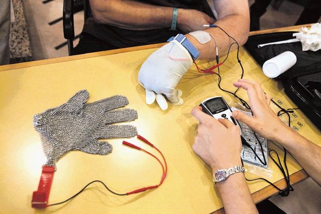Električno draženje roke z mrežasto rokavico 
