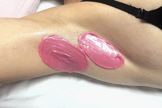 Pri depilaciji pazduhe je Svetlana Arsič kožo zaščitila z oljem, nato pa nanjo nanesla topel vosek.