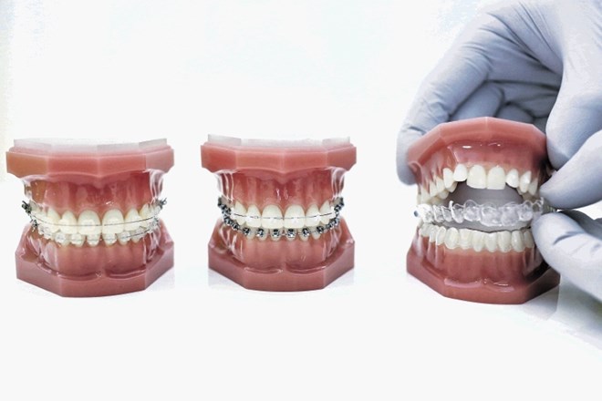 Različne vrste ortodontskih aparatov