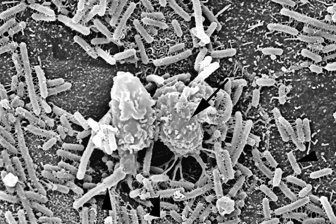 Makrofag, ki s površine okuženega sečnega mehurja odstranjuje bakterije E. coli.