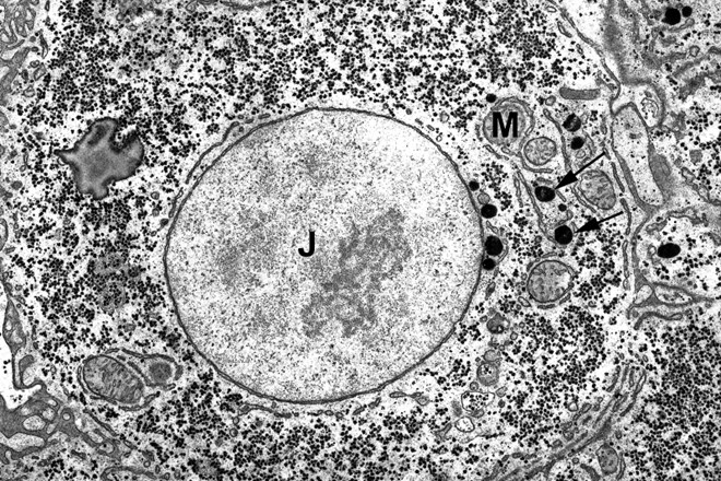Jetrna celica z jedrom (J) in mitohondriji (M)