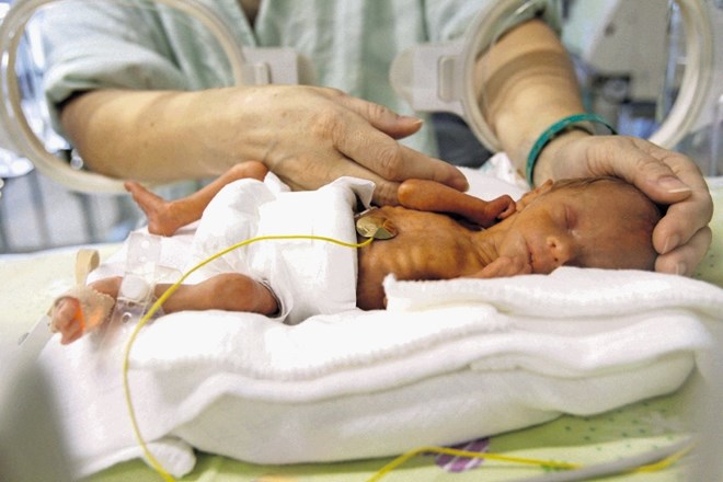 Ob preeklampsiji se rojevajo zelo nedonošeni otroci, pogosto v 25. do 27. tednu nosečnosti.