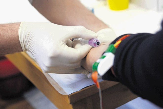 Testiranje na okužbo s HIV je anonimno in brezplačno.