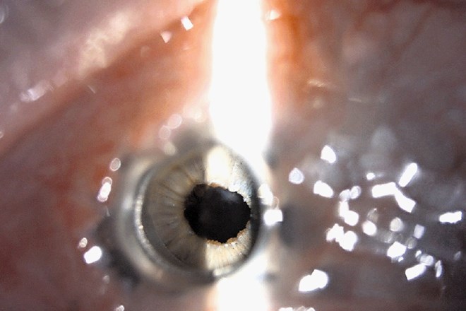 Prosta optična os po posegu z vidno funkcionalno šarenico za optiko keratoproteze