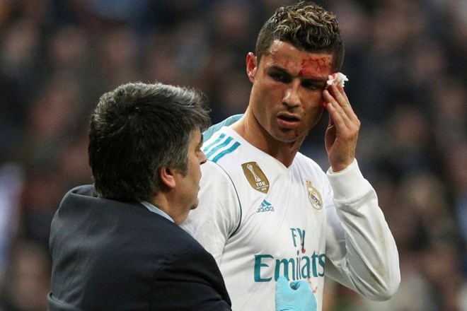 #foto #video Ronaldo rano nad očesom med tekmo preveril kar na telefonu