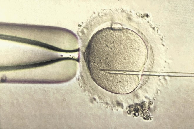 Postopek ICSI:  pod mikroskopom ujamejo semenčico v cevčico in jo vbrizgnejo v jajčno celico.