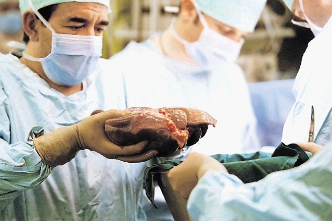 Na podarjene organe in tkiva čaka več bolnikov, kot je darovalcev.