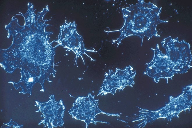 Za rakave celice je značilna nenadzorovana celična delitev.