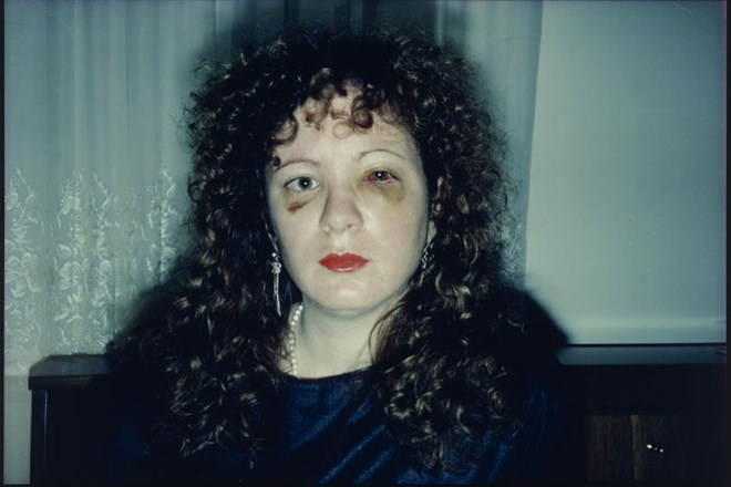 Nan Goldin je leta 1984 ustvarila ta srhljivi avtoportret z naslovom Nan One Month After Being Battered (Nan mesec dni po...