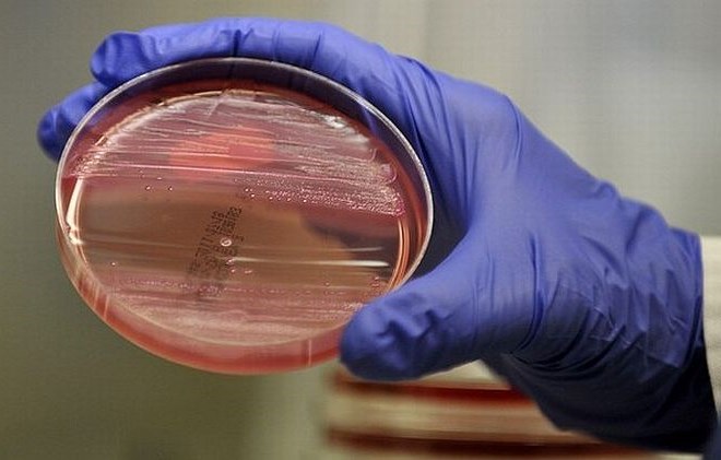 Nemčija je razglasila konec izbruha okužb z bakterijo E.coli
