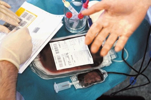 Imunoglobulini so  v primeru Zavoda za transfuzijsko medicino   izdelani iz plazme slovenskih krvodajalcev, pri Kemofarmaciji...