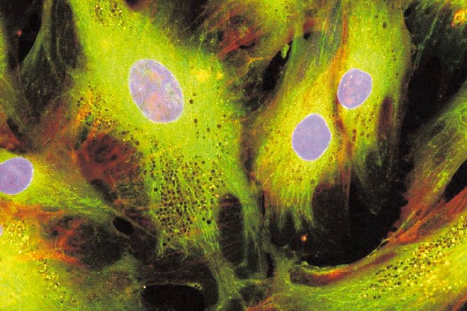 Mezenhimske matične celice