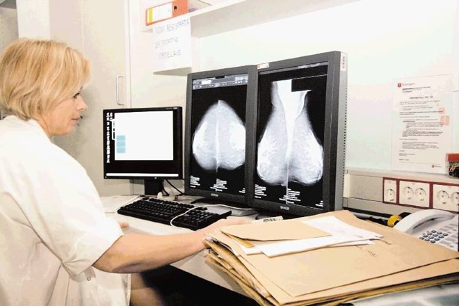 Na Onkološkem inštitutu  Ljubljana odčitavajo mamografske slike na oddelku za radiologijo. 