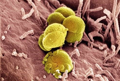 Britanski znanstveniki odkrili ahilovo peto superbakterij