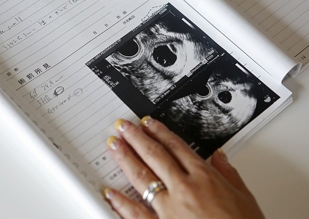 Hrvaškim bolnišnicam napovedujejo kazni za zavrnitev splava 