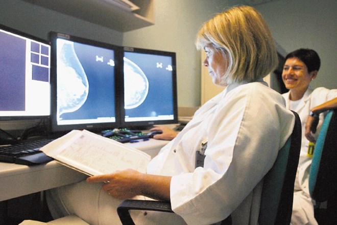 V Sloveniji za rakom dojke zboli 1200 žensk na leto. 