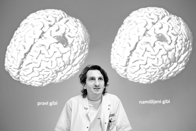 Blaž Koritnik, nevrolog: Glede presajanja glave ostajajo tako praktični kot moralni pomisleki