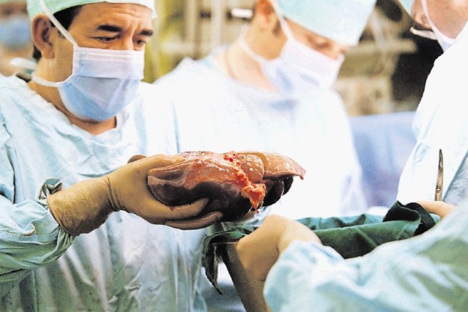 Druga jetra je lani dobilo 17 bolnikov.