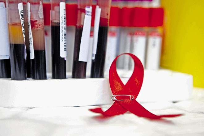 Pilotni projekt predekspozicijske profilakse (PrEP), ki ščiti pred prenosom HIV, je pripravljen.