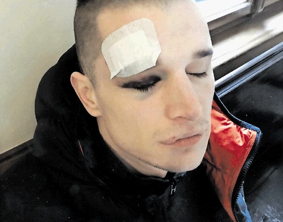 Odvetnik Miloš Zarić je v spis vložil fotografijo poškodb obtoženca ob aretaciji, s pomočjo katerih želi iz spisa izločiti...