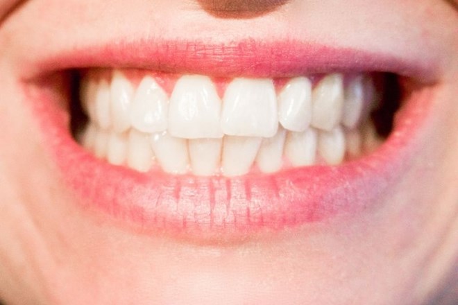 Beli zobje niso nič bolj zdravi od rumenkastih 