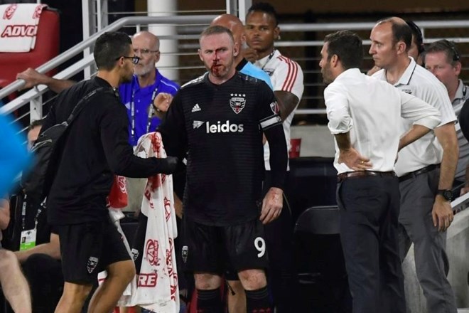 #video Rooney zabil prvi gol, nato zlomil nos 