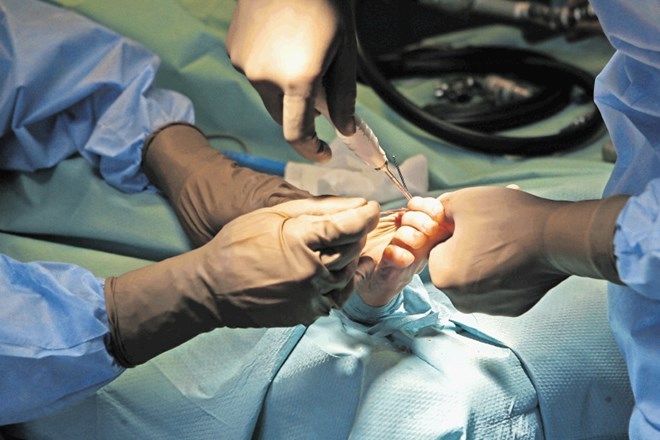 Operacija nožnega palca je med zdravljenji, na katera bolniki čakajo najdlje.