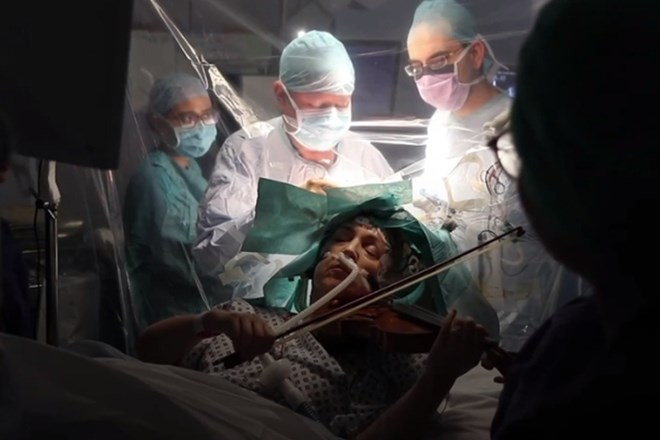 #video Med odstranjevanjem tumorja igrala violino