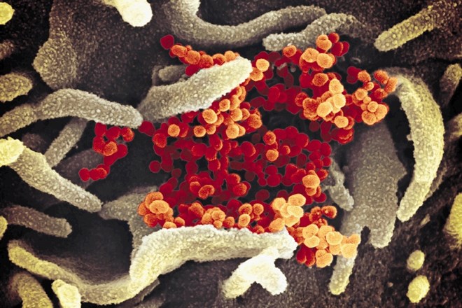 Virus SARS-CoV-2  (v oranžni barvi), ki povzroča bolezen COVID-19, pod elektronskim mikroskopom Nacionalnega inštituta za...