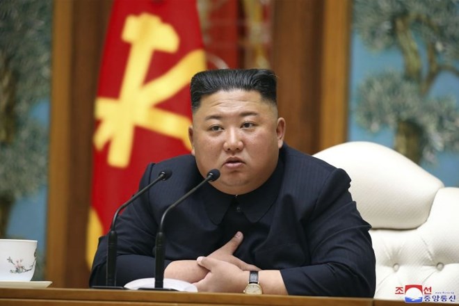 Kim Jong Un naj bi imel težave zaradi kajenja, stresa in prekomerne teže.