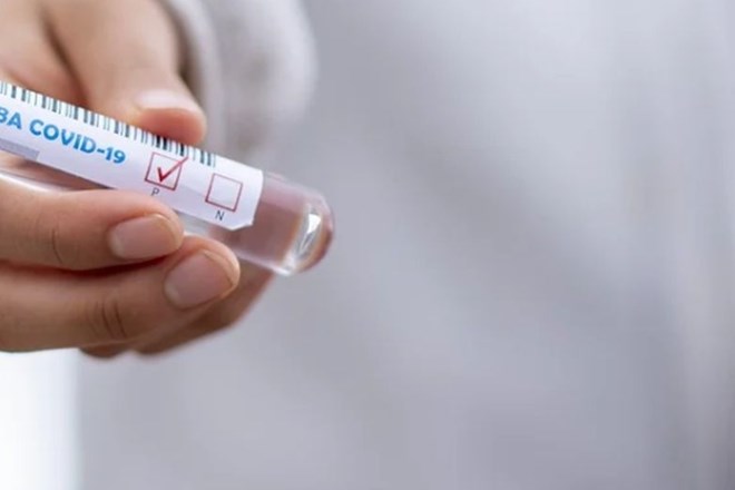 Kemijskemu inštitutu dovoljenje za testiranje cepiva proti covidu-19 na miših