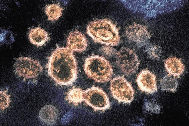 Novi koronavirus: O tihih prenašalcih in cepivu