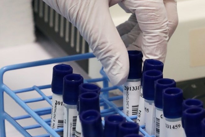 Včeraj so v Sloveniji opravili 1168 testov in potrdili 43 novih okužb.