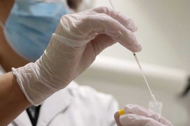  V ponedeljek potrdili 794 okužb z novim koronavirusom, dva bolnika s covidom-19 umrla