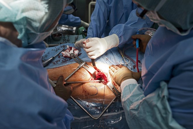 Stavka zdravnikov: Kako bodo prestavljali operacije in preglede