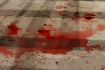 Žena v Krškem napadla soproga z nožem; v Novem mestu pa 32-letnik zabodel 20-letnika