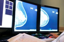 Boj proti raku na dojki v Sloveniji vse bolj uspešen in primerljiv z zahodno Evropo