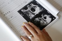 Hrvaškim bolnišnicam napovedujejo kazni za zavrnitev splava 