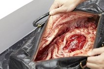 Prestižne torbice, polne organov in krvi