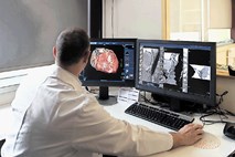 V UKC Ljubljana dobili nov CT-aparat za najzahtevnejše preiskave