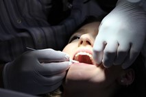 Britanski znanstveniki odkrili zdravilo za obnavljanje zob