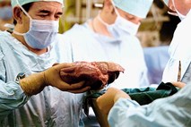 Lani manj presaditev organov kot v zadnjih petih letih