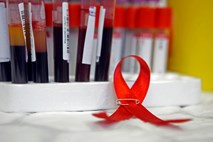 Boj proti aidsu: Tretjina za svojo okužbo s hiv sploh ne ve