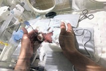 Japonsko bolnišnico zapustil najmanjši novorojenček na svetu