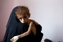Unicef zbira pomoč za podhranjene otroke v Jemnu