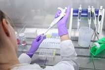Zakaj ZDA in Rusija nočeta uničiti zadnjih smrtonosnih vzorcev virusa črnih koz