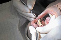 Zobozdravniki v dilemi: kako ravnati ob italijanskih pacientih