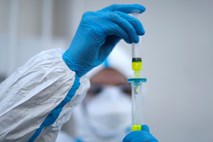 V Sloveniji po ocenah okužena ena na vsakih 33 oseb, z novimi testi do izvida znotraj nekaj ur