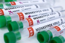 EU bo kupila 110.000 odmerkov cepiva proti opičjim kozam